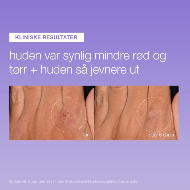 Hovedbilde stabilizing repair serum