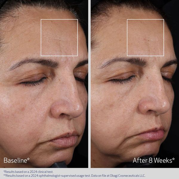ELASTIDERM ADVANCED FILLER CONCENTRATE
