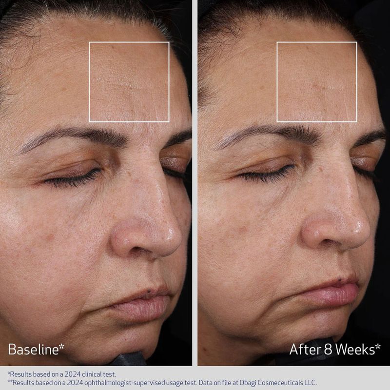 ELASTIDERM ADVANCED FILLER CONCENTRATE