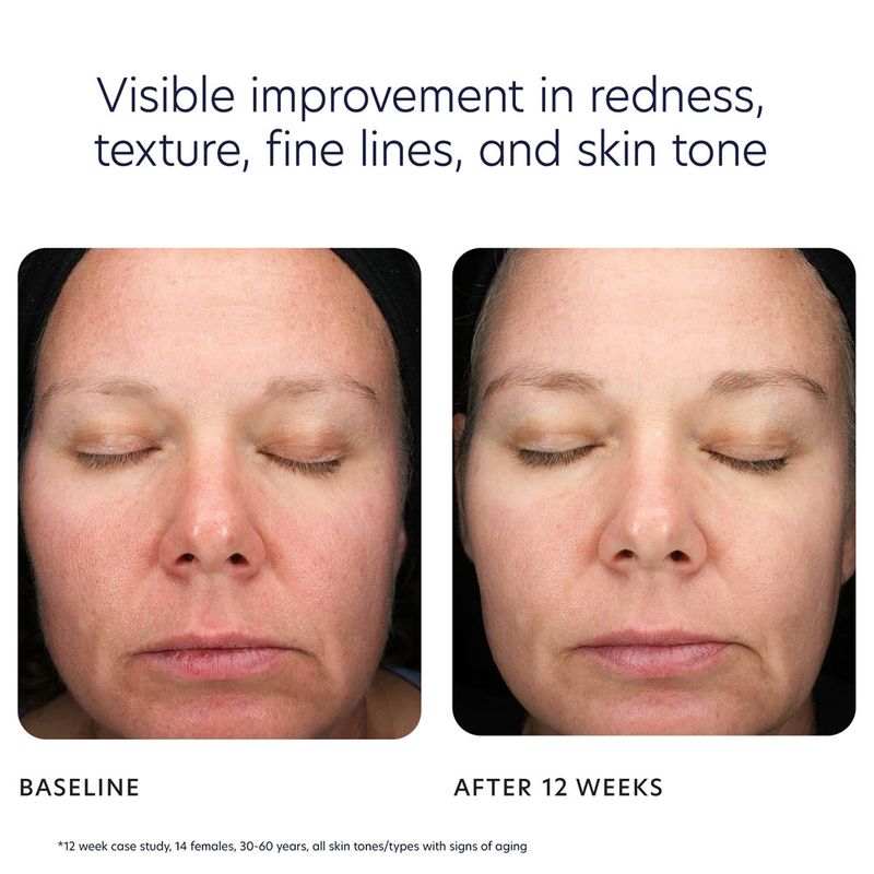 Triple Exfoliation Peel Pads
