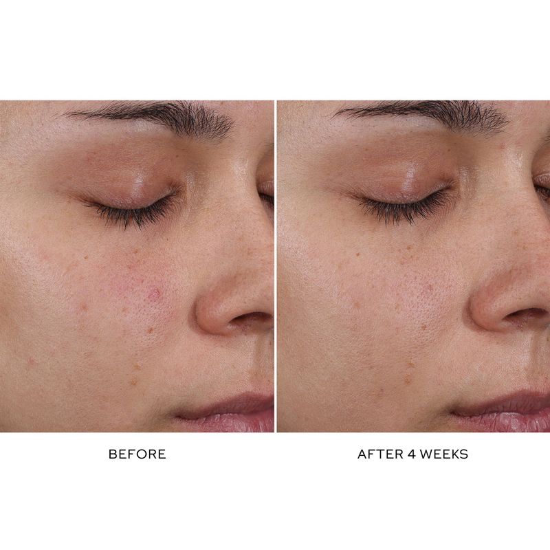 Pore Refining Complex Serum